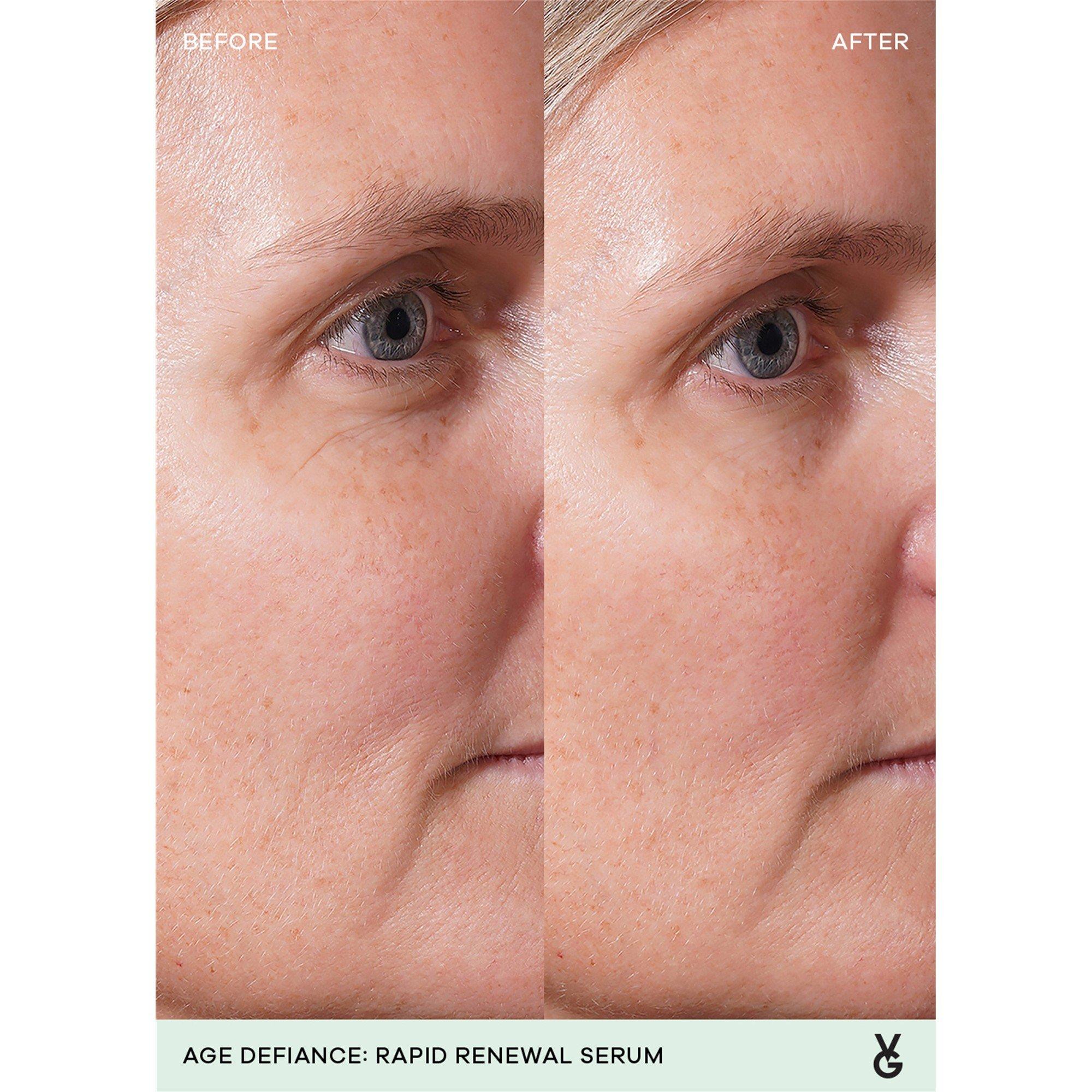 Not Applicable - Vida Glow - Women's Age Defiance Renewal Face Serum - 5