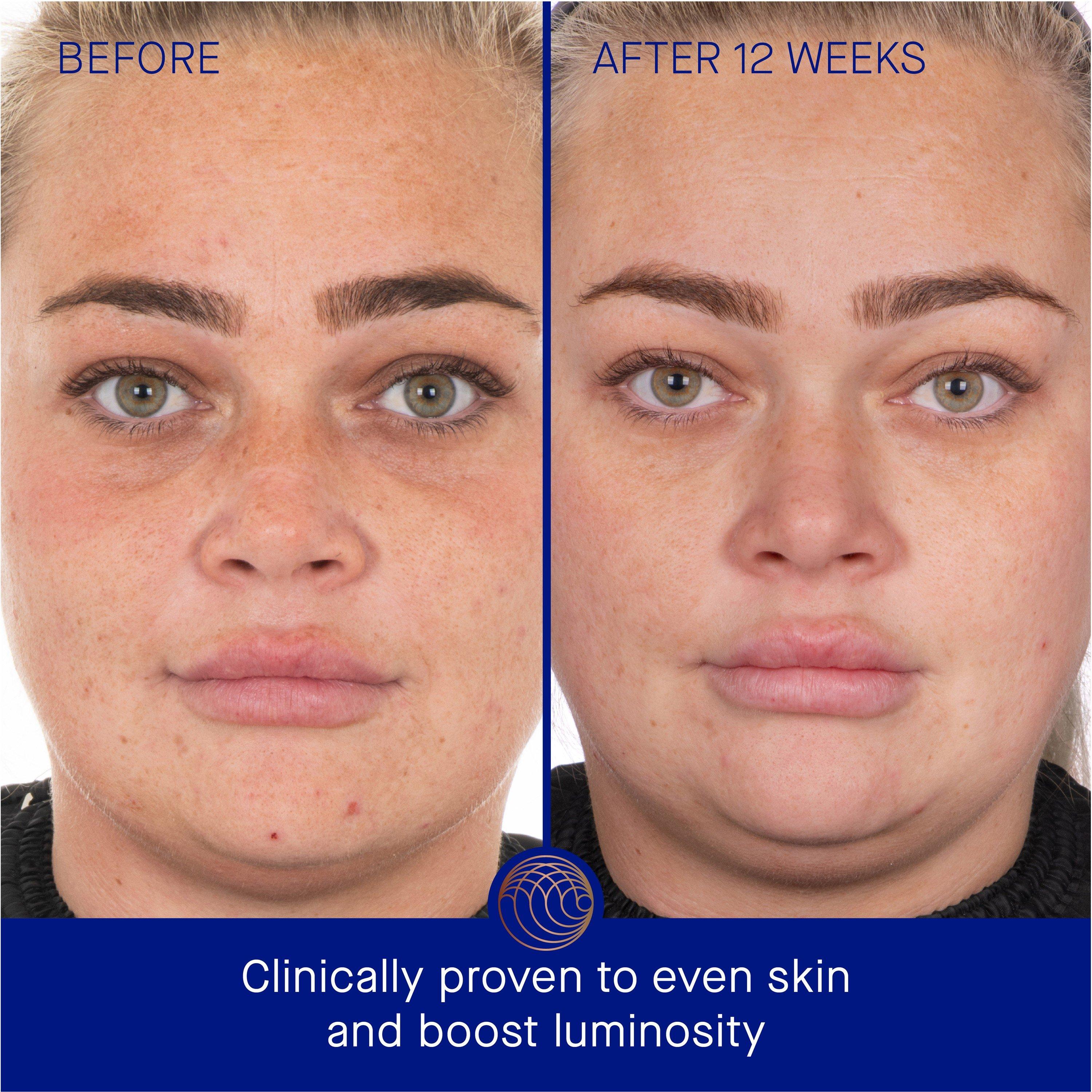Not Applicable - Augustinus Bader - THE FACE CREAM MASK - 4