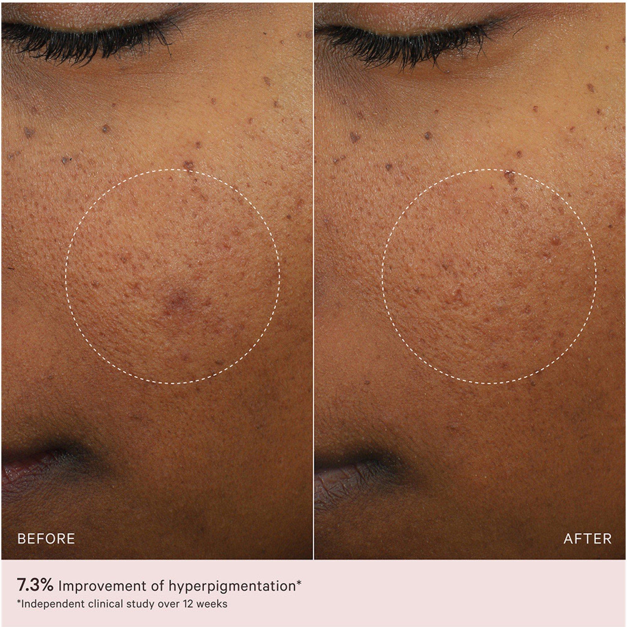Not Applicable - MZ Skin - MICRO PEELING GLOW ESSENC - 6