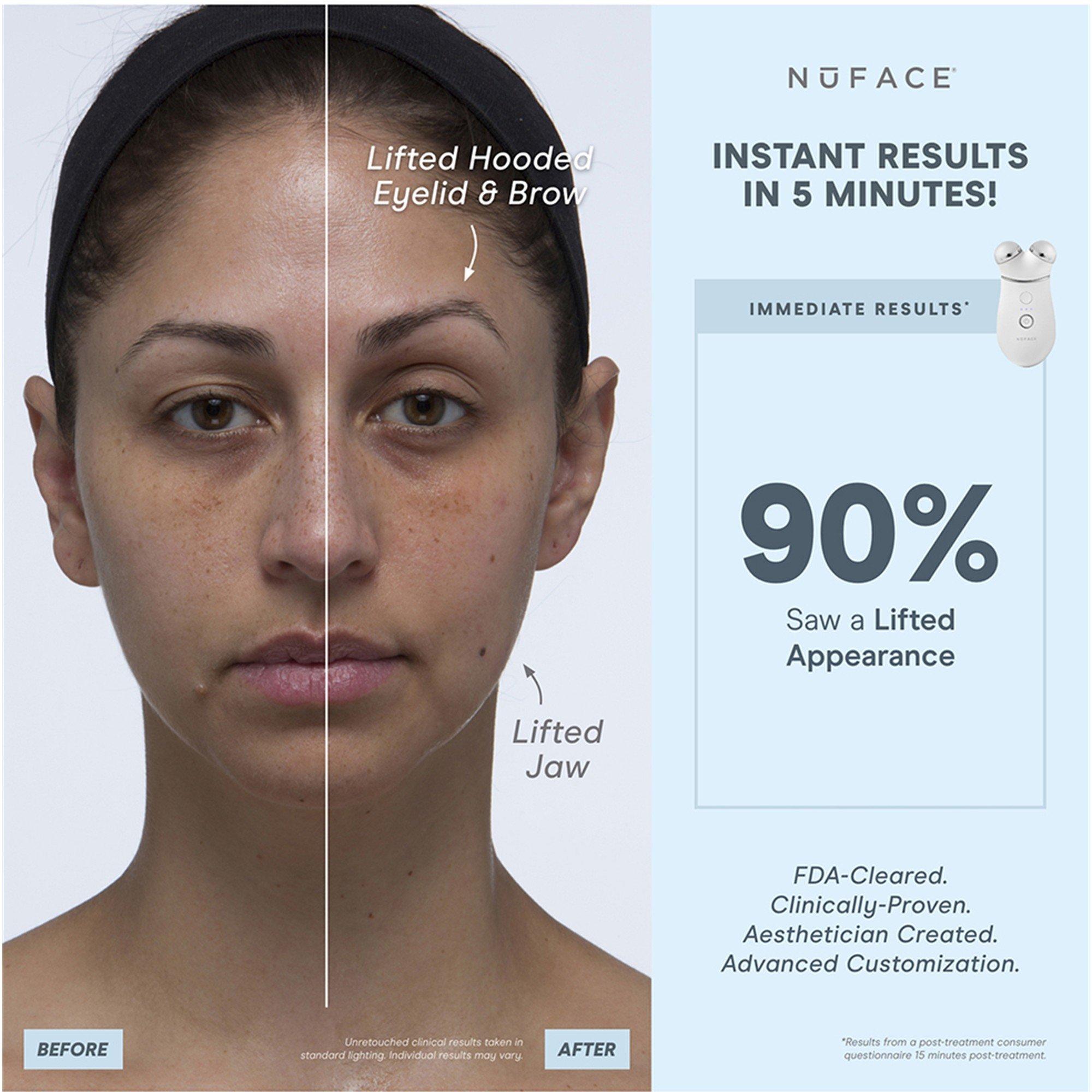 Not Applicable - Nuface - TRINITY+ STARTER KIT - 5