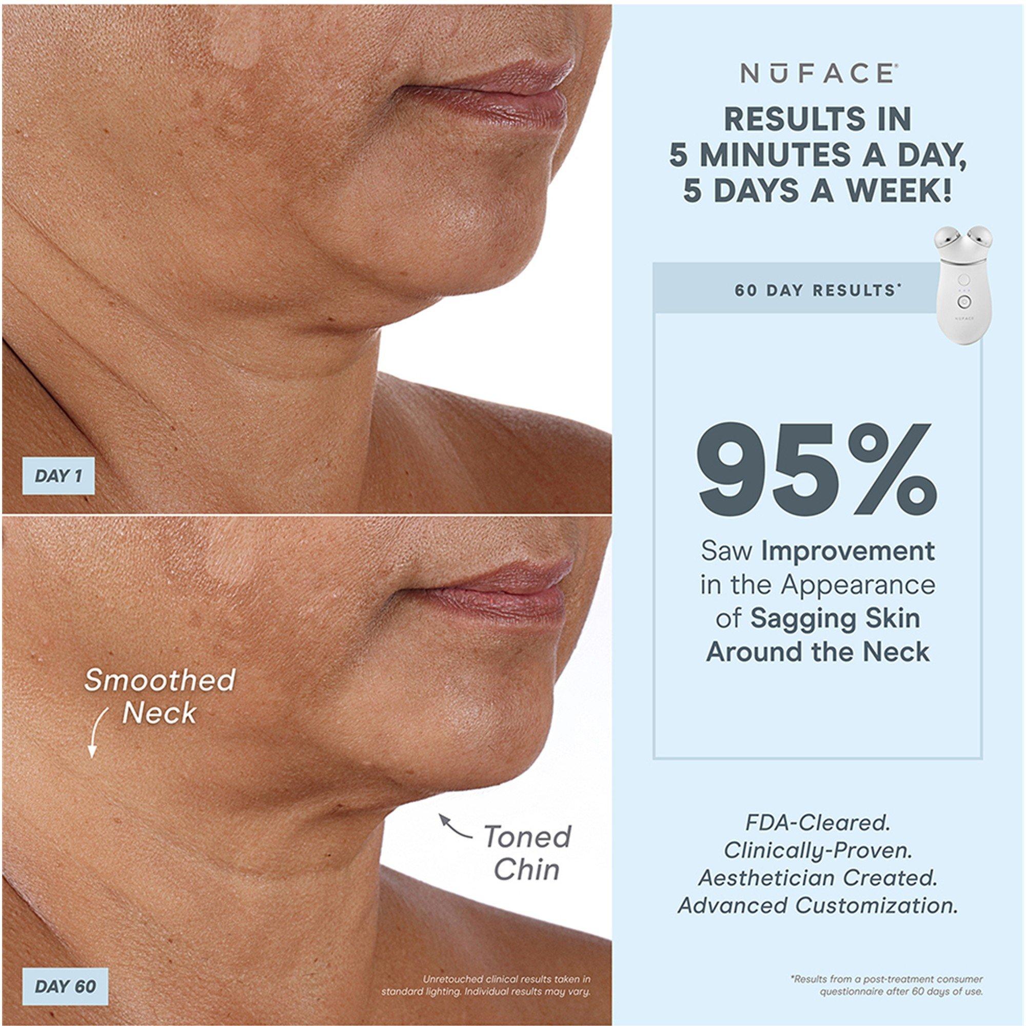 Not Applicable - Nuface - TRINITY+ AND WRINKLE REDU - 2