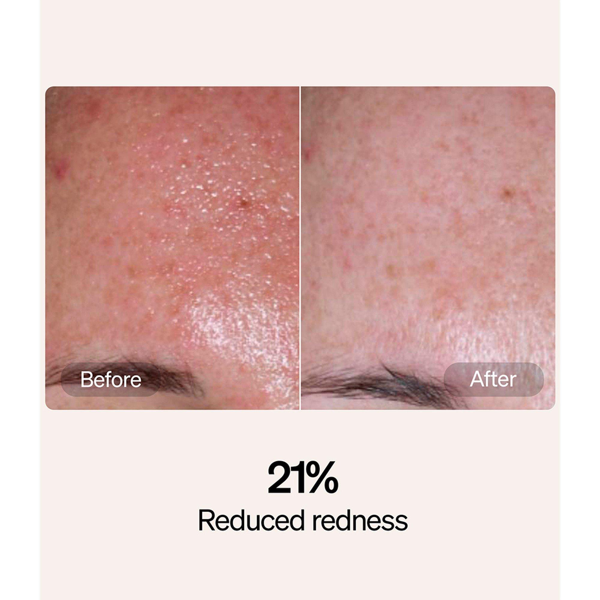 Not Applicable - LYMA - SERUM AND CREAM STARTER K - 6