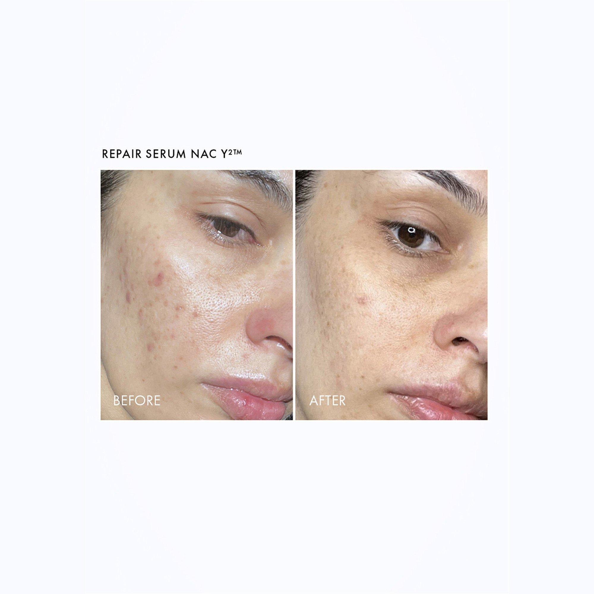 Not Applicable - 111SKIN - Repair + Renew Routine - 6