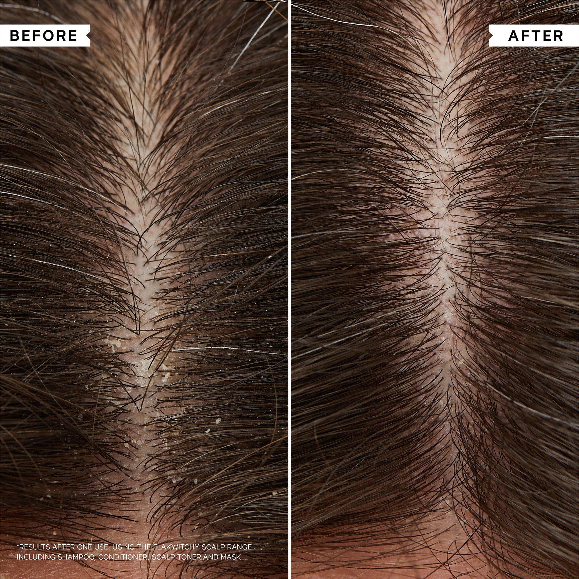 Clear - Philip Kingsley - PKFlk/ItchSclpHydCrl Ld00 - 5