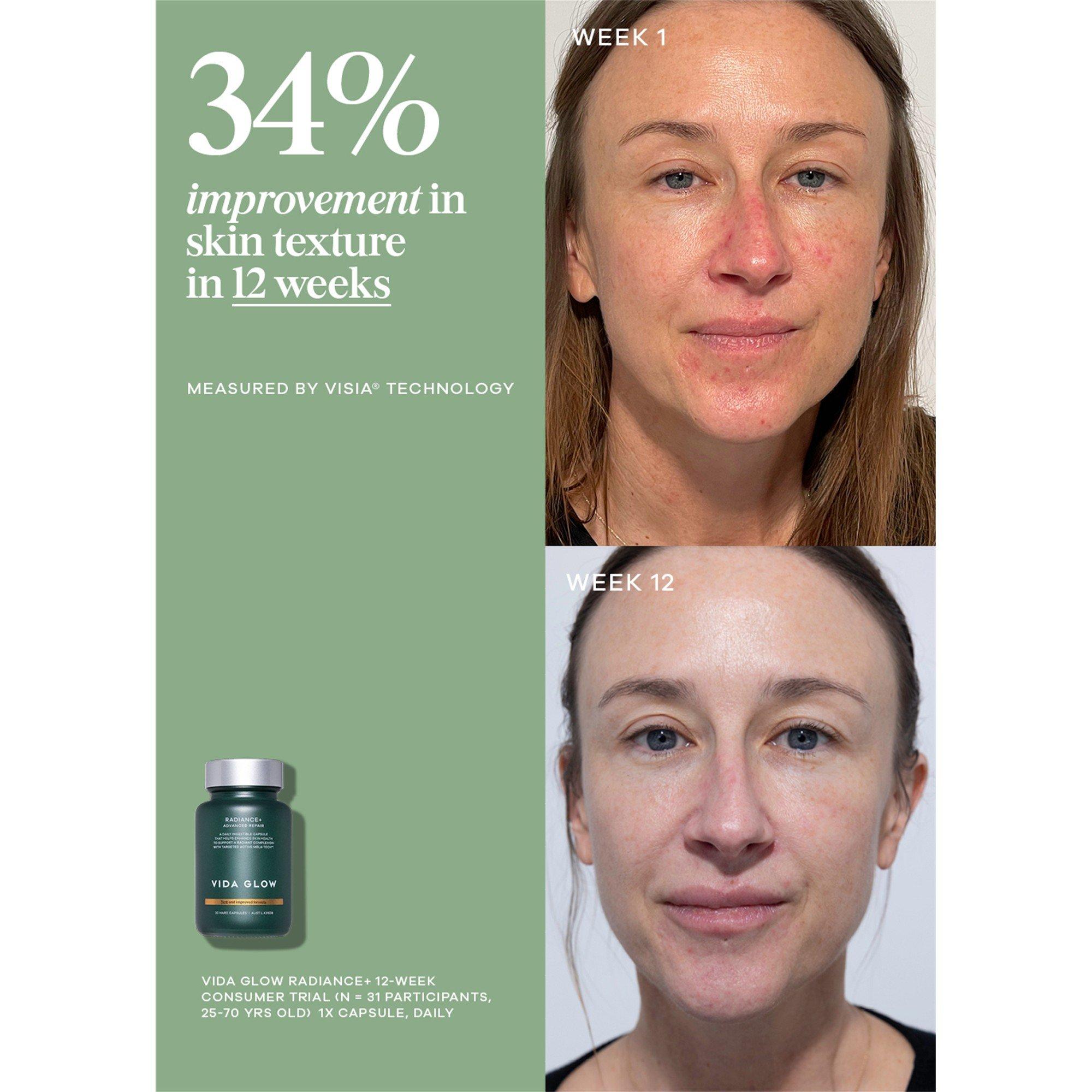 Not Applicable - Vida Glow - Radiance+ Vitamin - 4