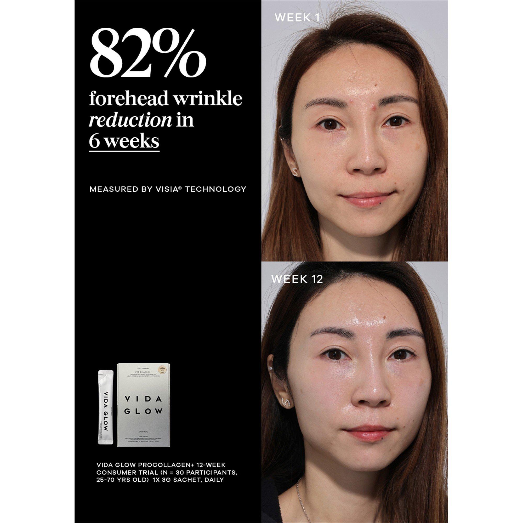 Not Applicable - Vida Glow - Pro Collagen+ Vitamin - 5