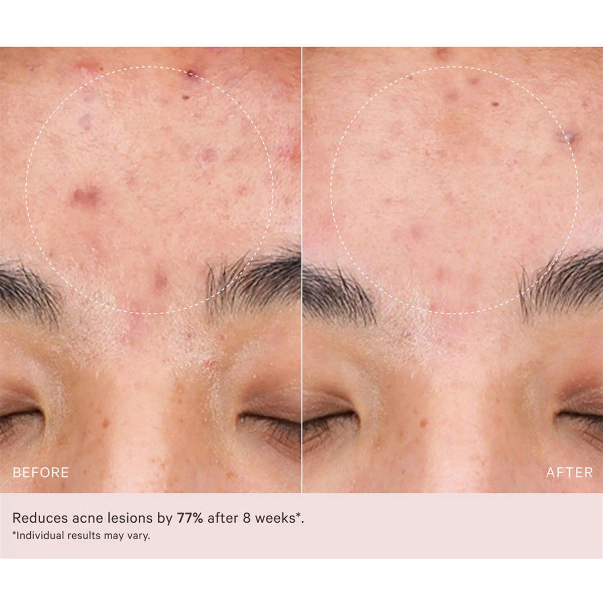 Not Applicable - MZ Skin - LIGHTMAX SUPERCHARG LED M - 6