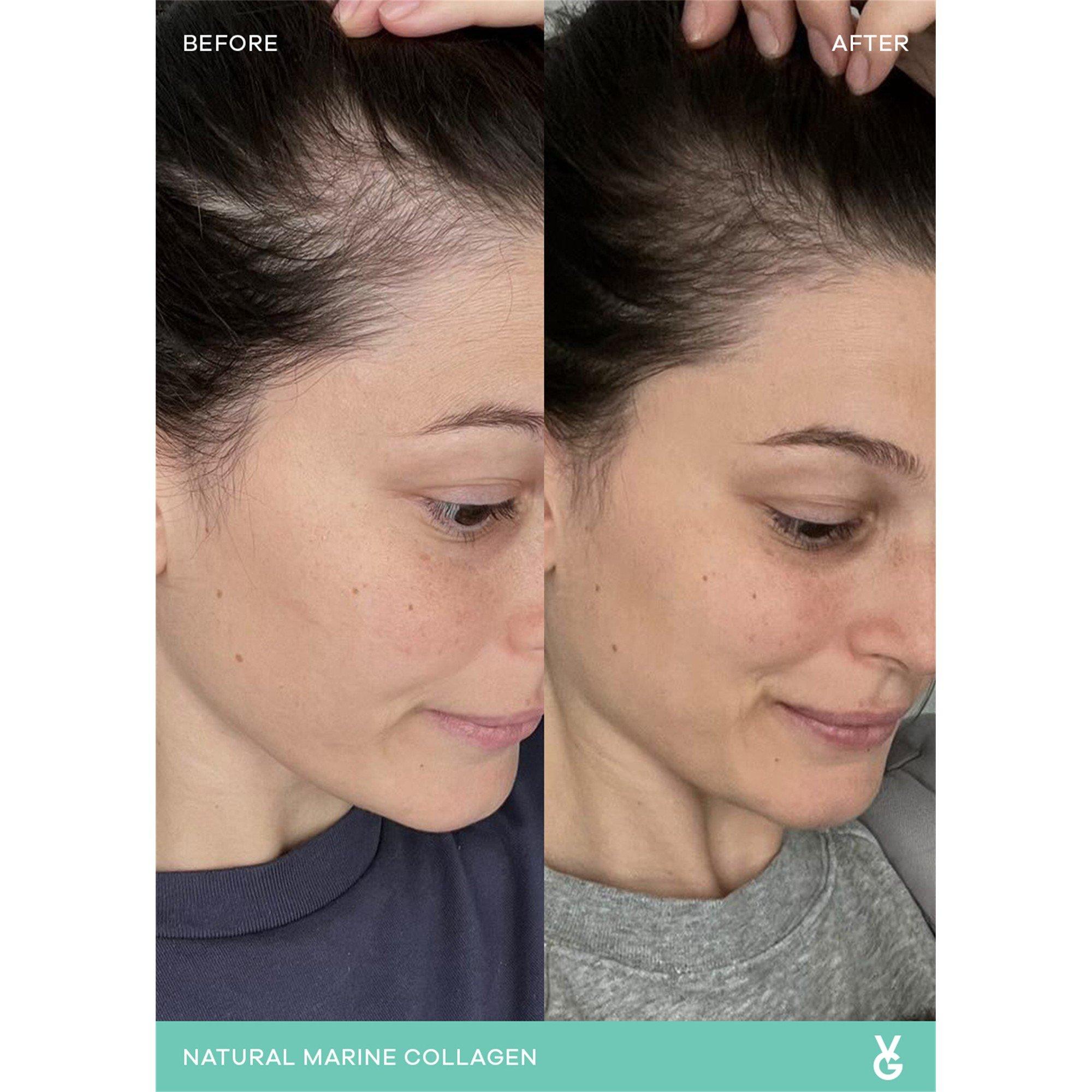 Not Applicable - Vida Glow - MARINE COLLAGEN - ORIGINA - 6