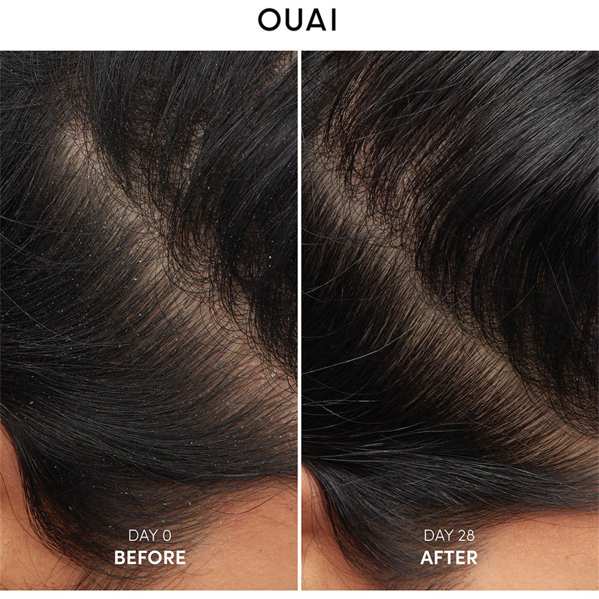 Not Applicable - Ouai - ANTI DANDRUFF SHAMPOO - 5