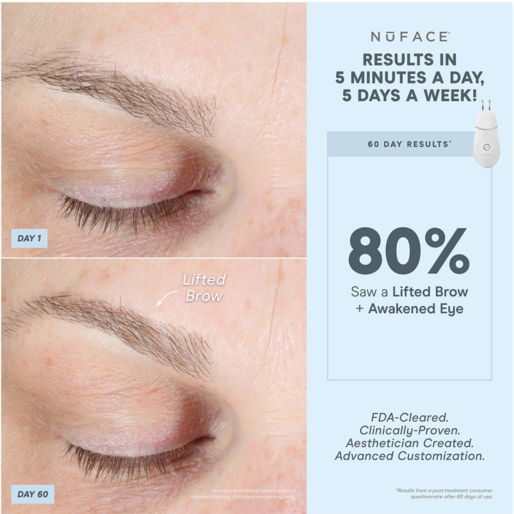 Not Applicable - Nuface - TRINITY+ AND LIP & EYE AT - 5