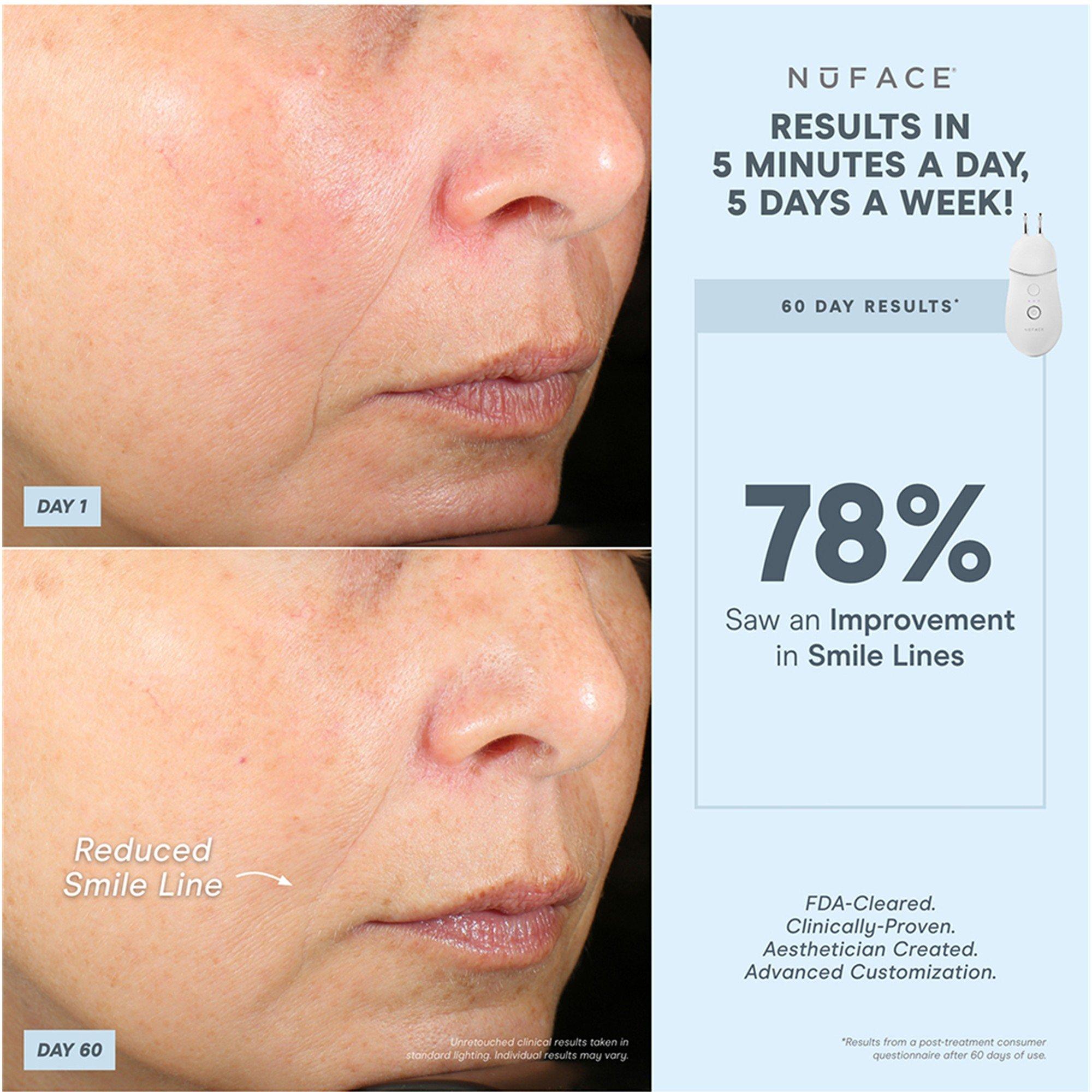 Not Applicable - Nuface - TRINITY+ AND LIP & EYE AT - 6