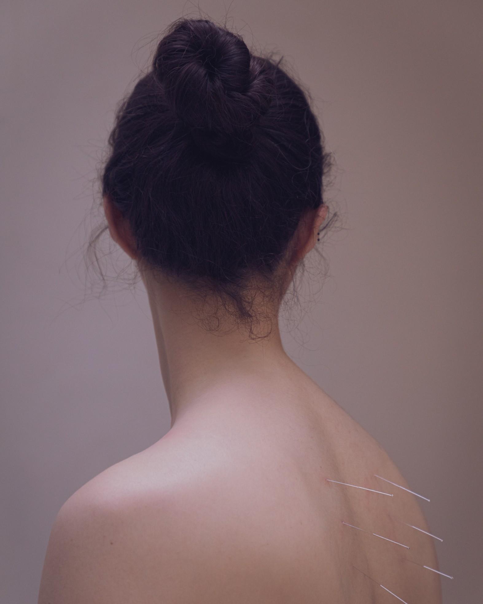 Johnny Childs, Five Element Acupuncturist