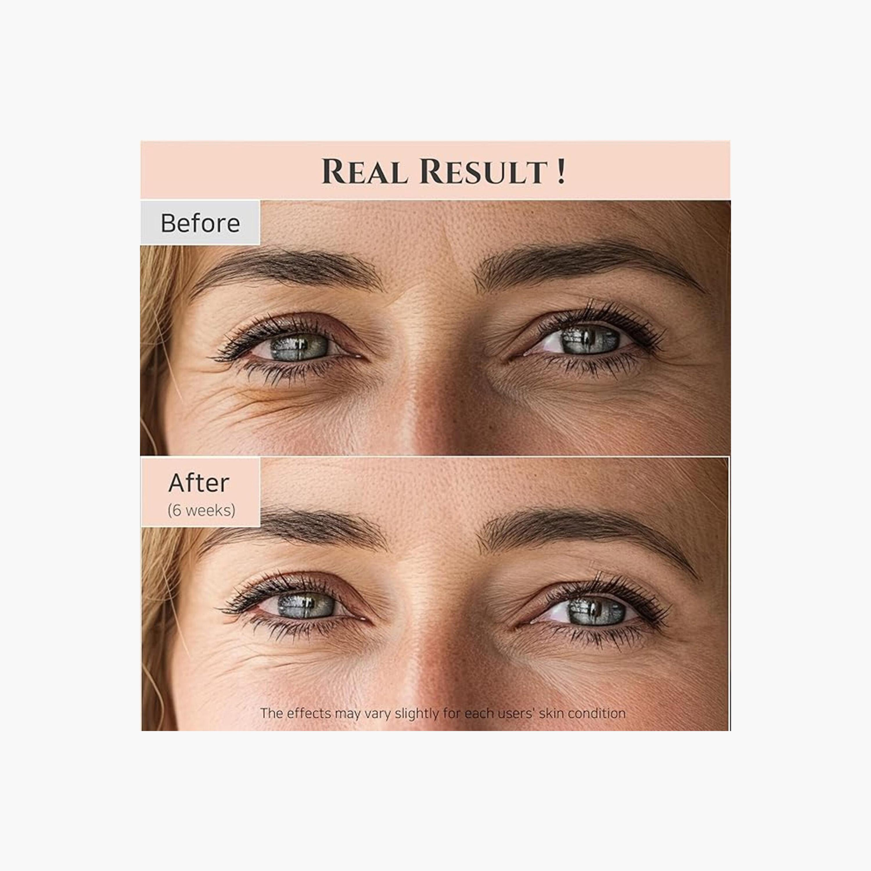 Beauty of Joseon Ginseng + Retinal Revive Eye Serum - 30 ml-beautyandpersonalcare-kbeauty-skin-treatmentsandserums-image-5