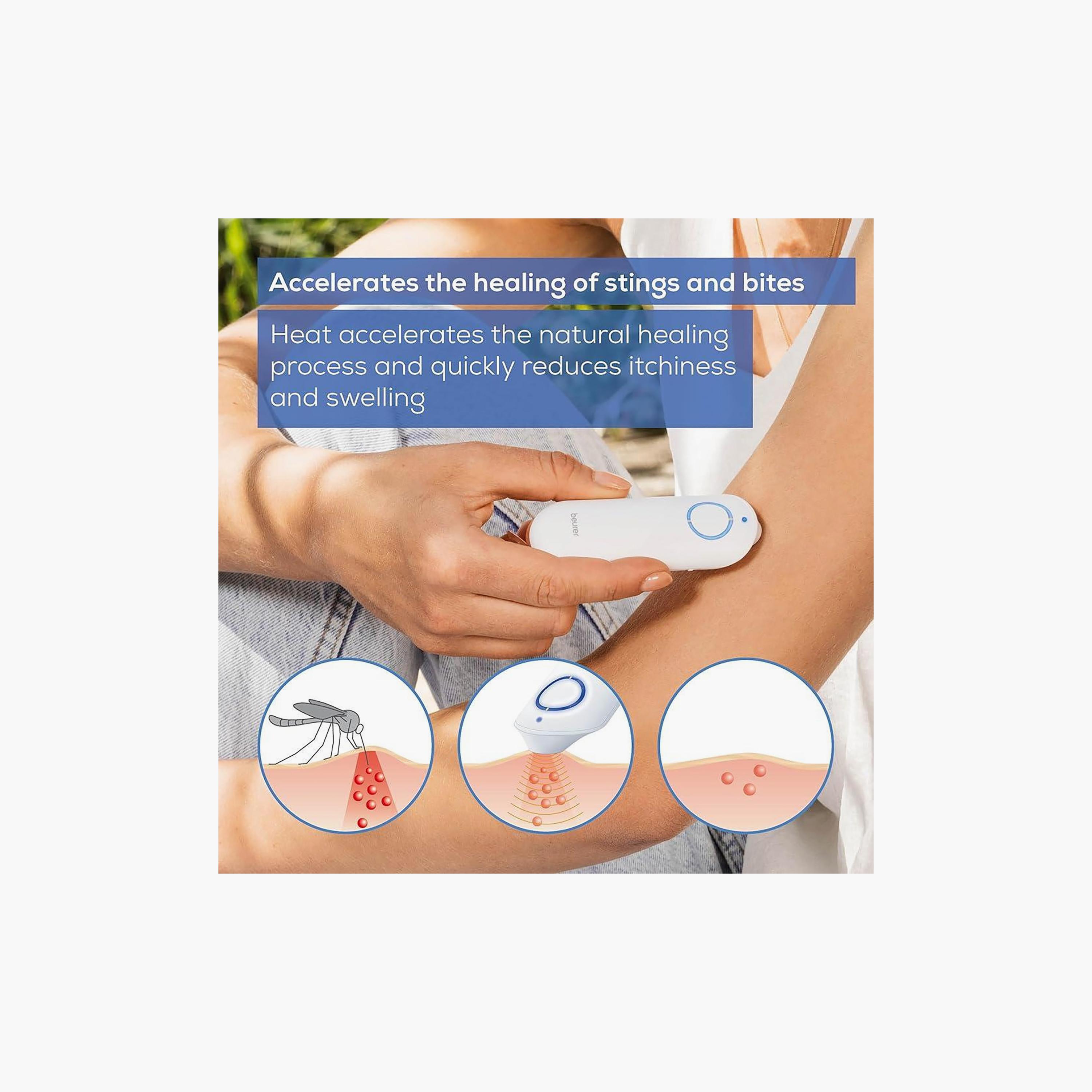 Beurer Insect Bite Healer Pen White | BR60-electronics-portabledevices-image-2