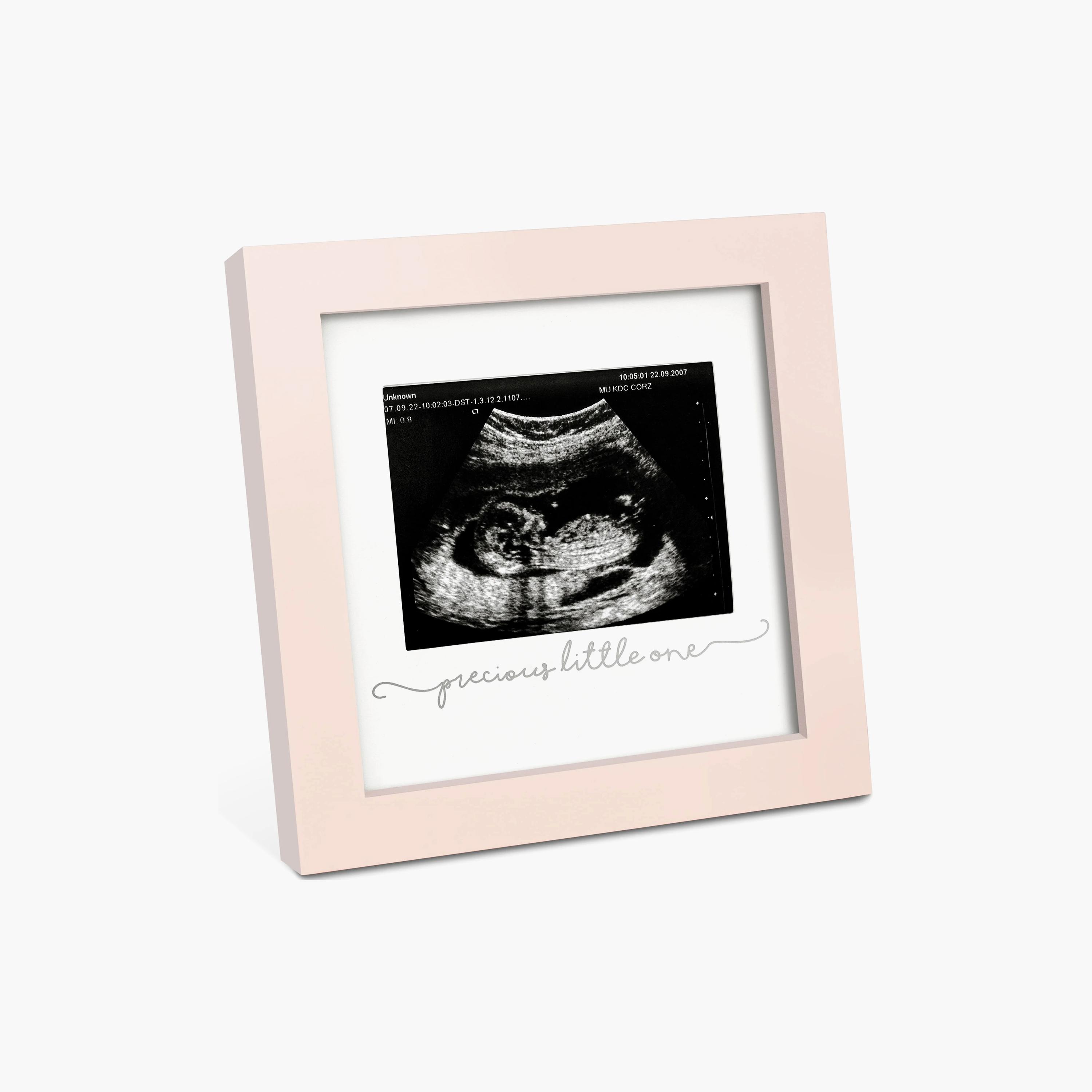 KeaBabies Solo Baby Sonogram Frame-baby-nursery-roomdecor-image-1