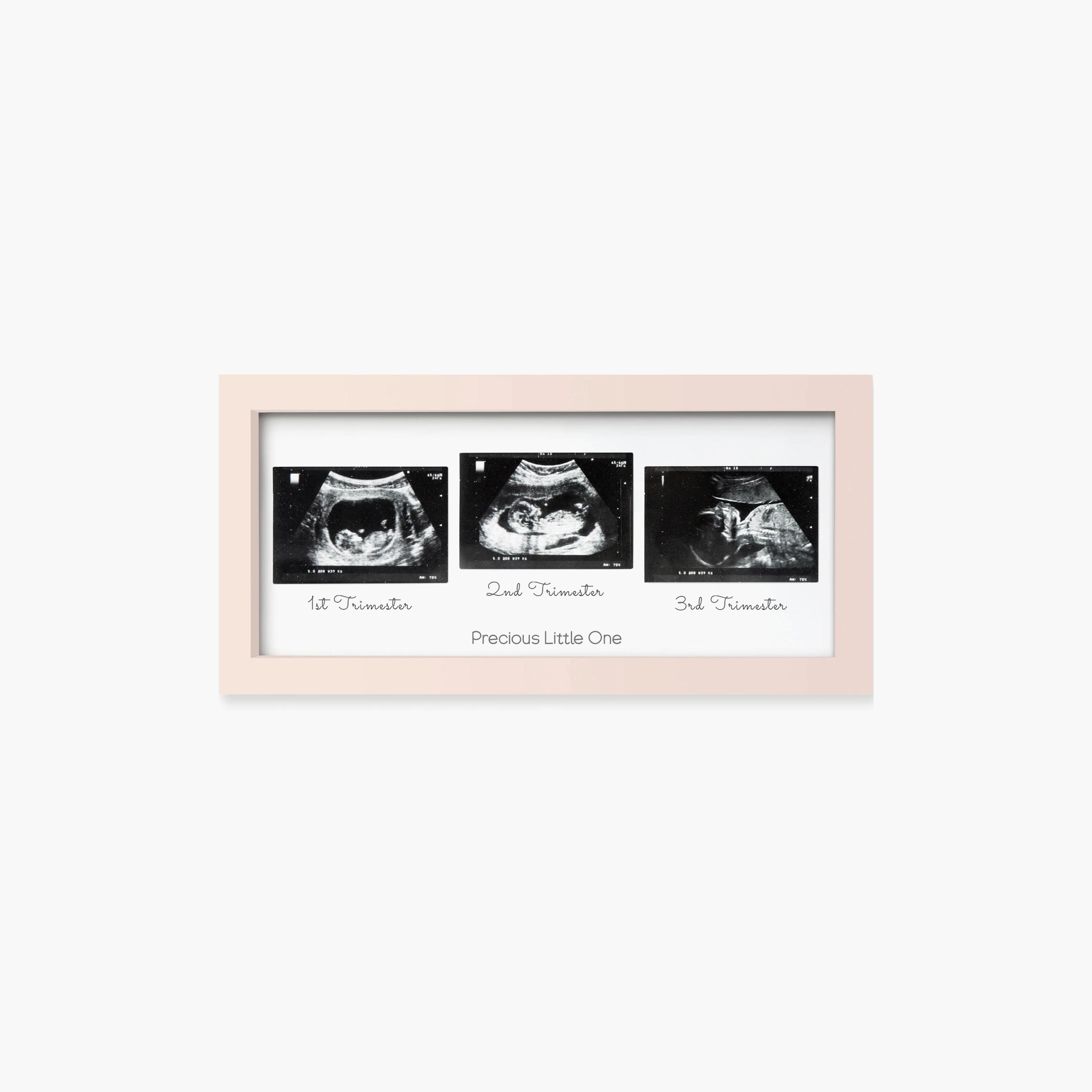 إطار صور سونار ثلاثي للأطفال من كيابيبيز-baby-nursery-roomdecor-image-1
