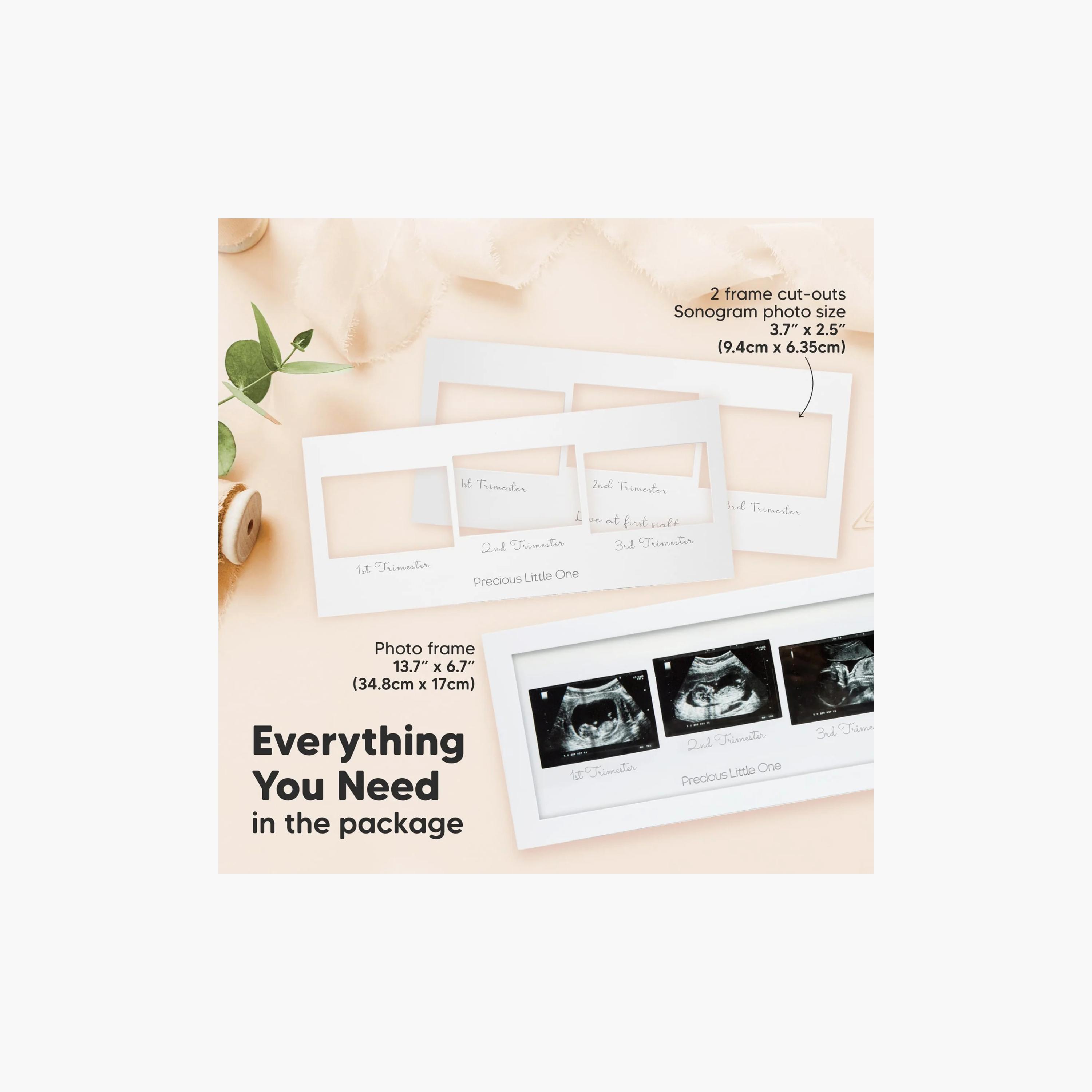 إطار صور سونار ثلاثي للأطفال من كيابيبيز-baby-nursery-roomdecor-image-8