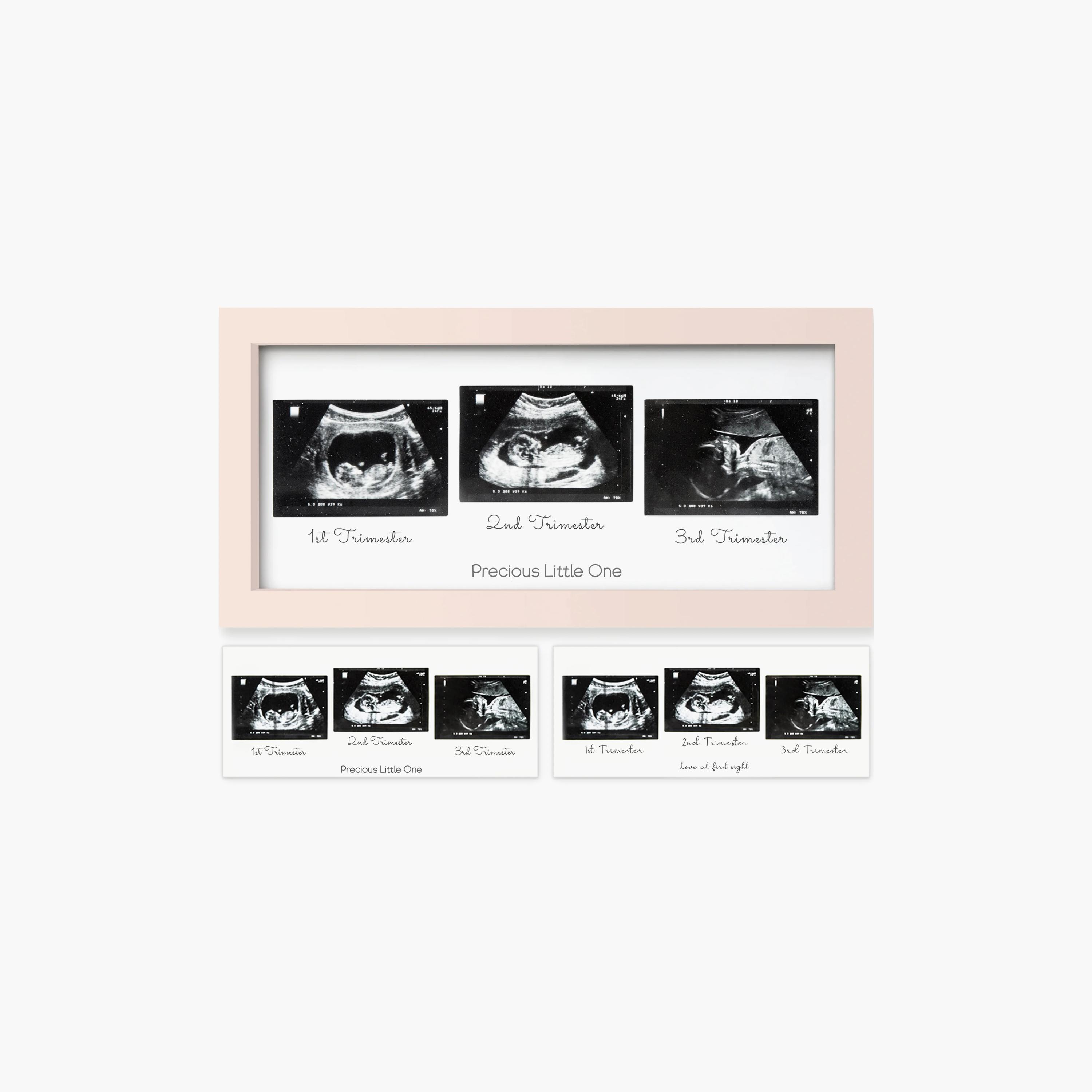إطار صور سونار ثلاثي للأطفال من كيابيبيز-baby-nursery-roomdecor-image-9