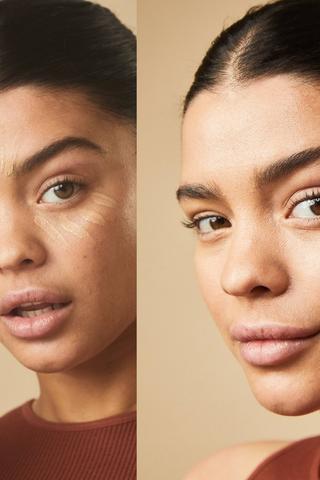 Misty Beige - Concealer