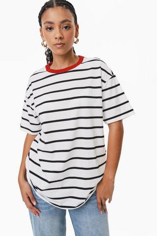 Stripe Oversized Top