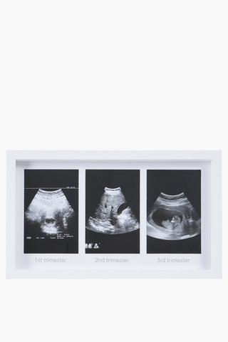 3 Piece Trio Scan Frame