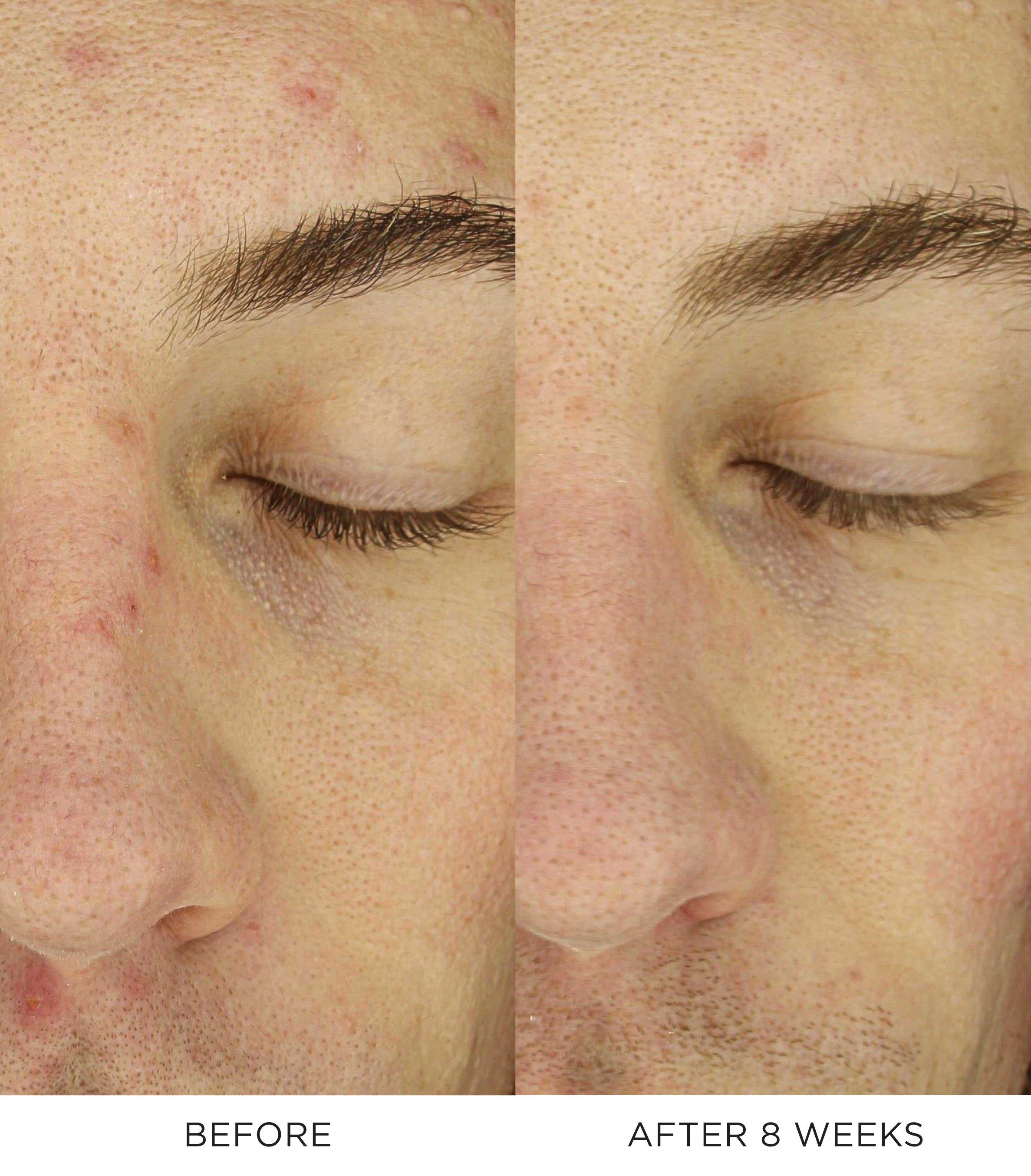 Overnight Chronobiology Peel​