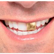 Gold Tooth