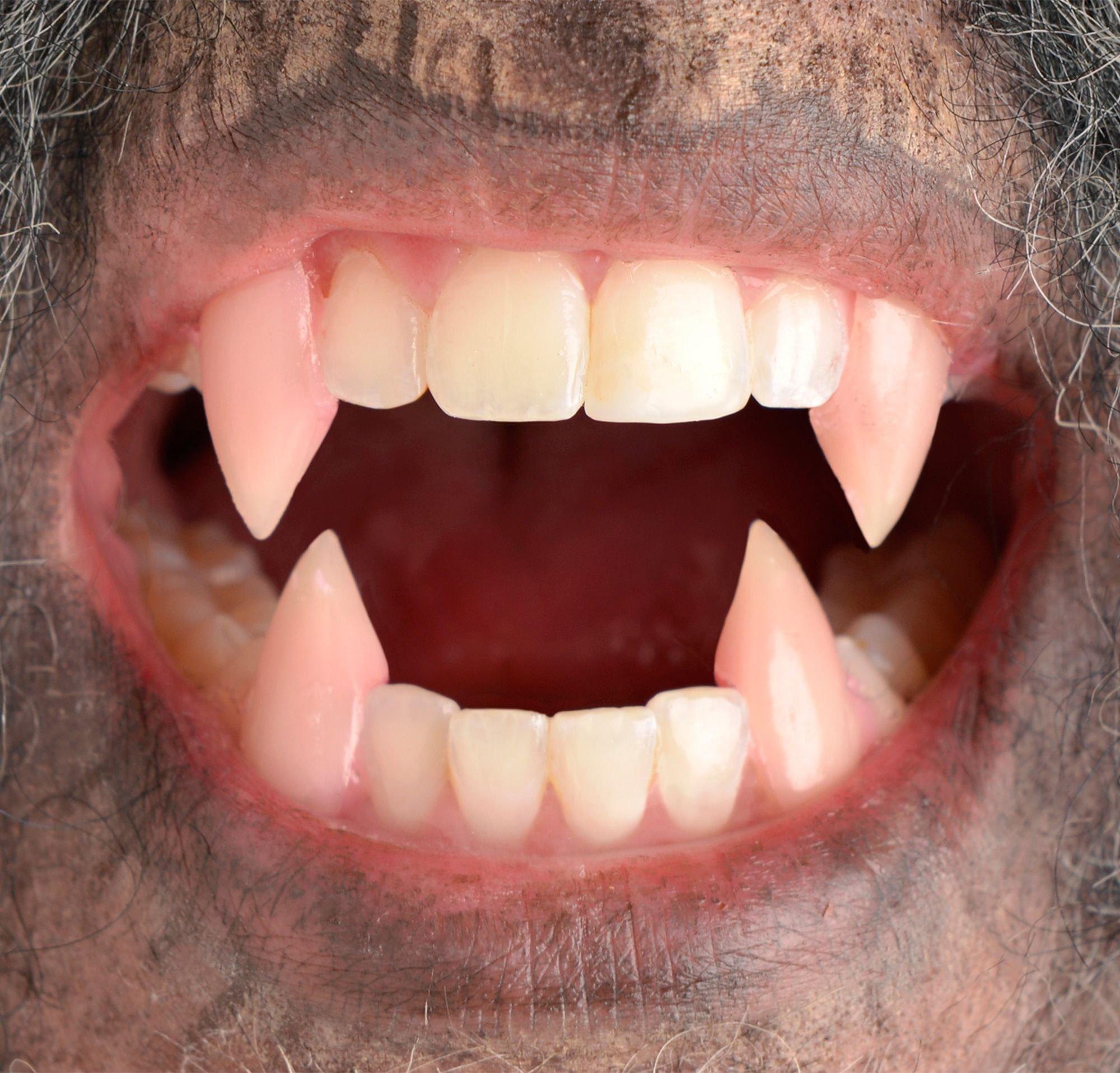 realistic werewolf fangs