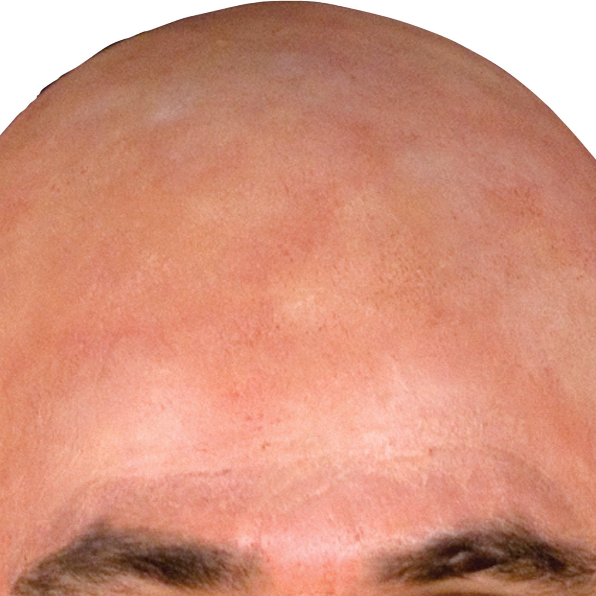 Natural Bald Cap