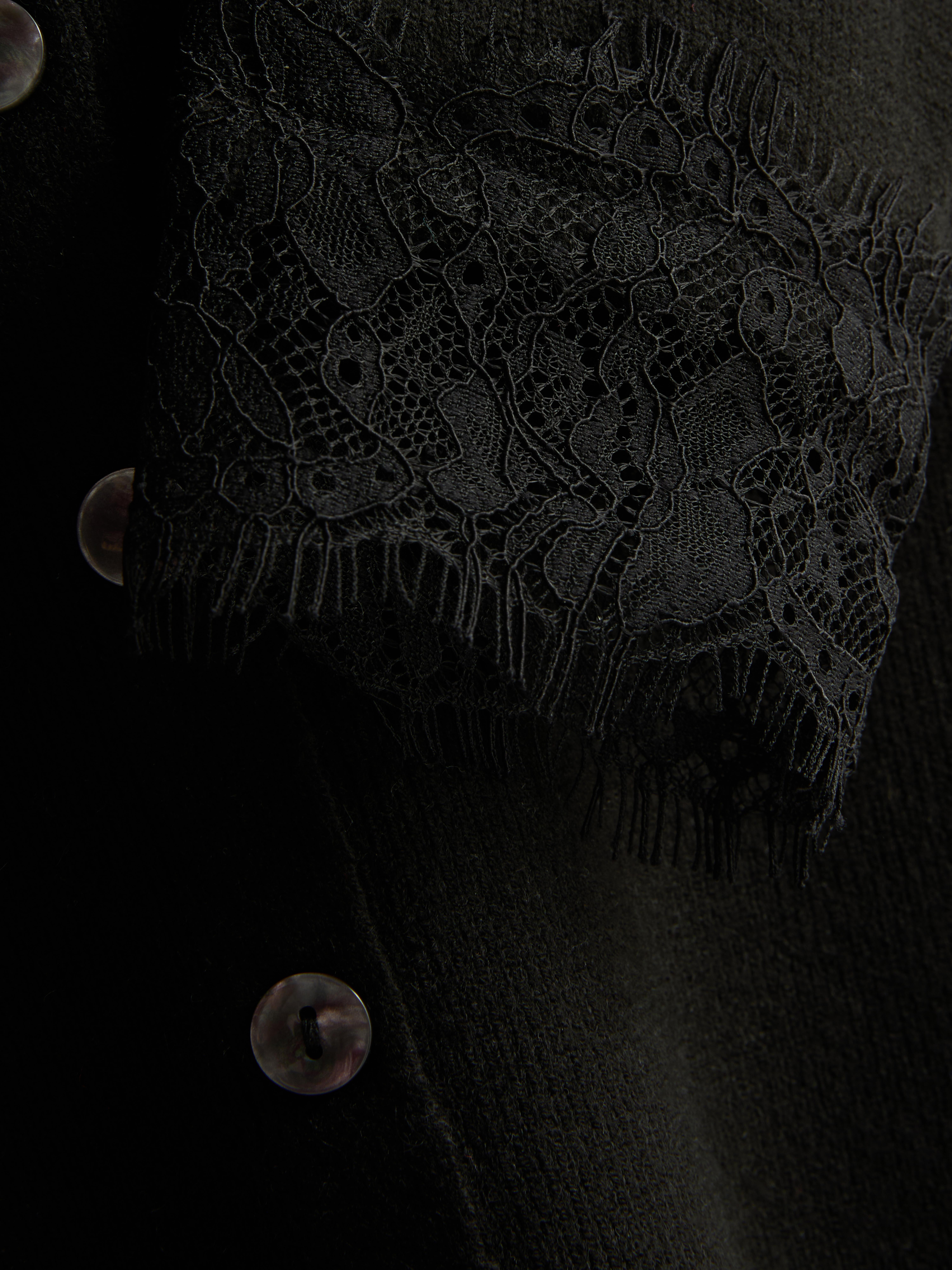 Lace Detail V-Neck Cardigan
