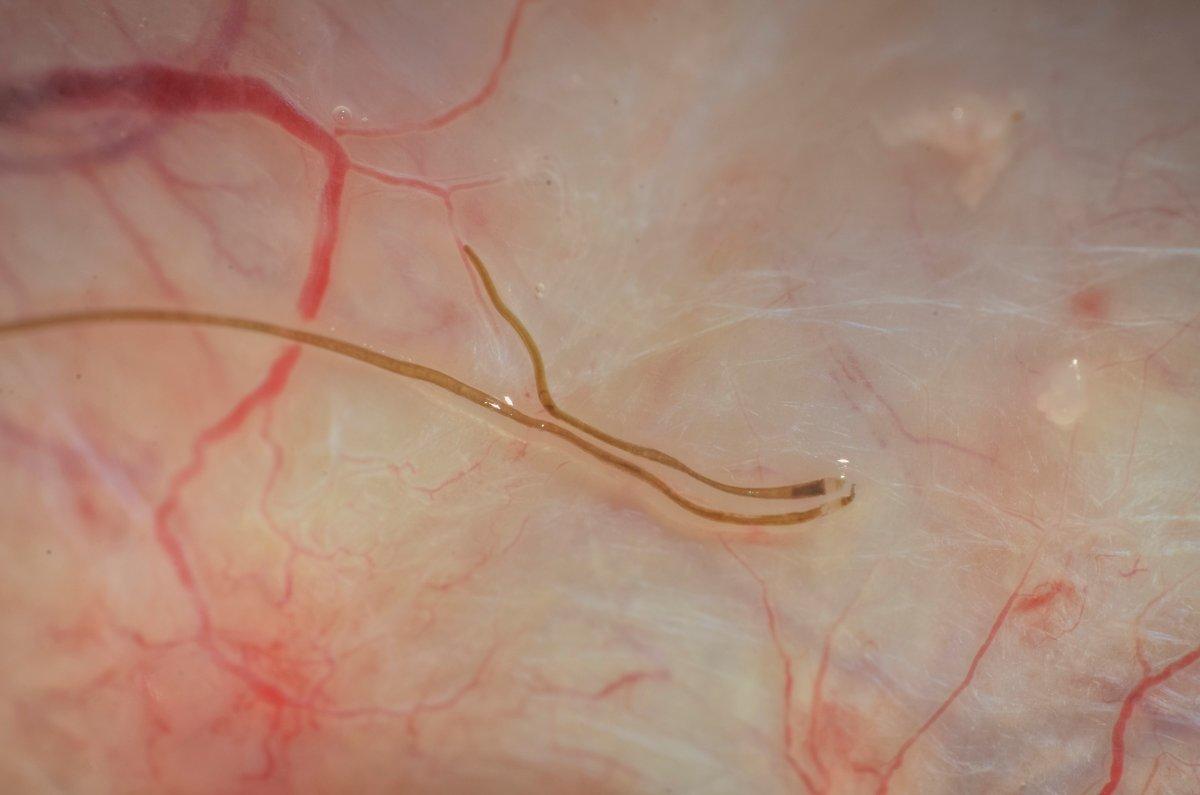 Brainworm in a white-tailed deer. (Joe Lacefield photo)