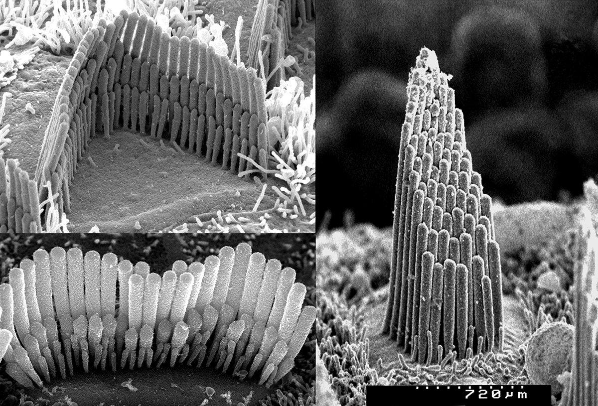 A magnified view of the inner ear hair cells. Image by Dr. David Furness