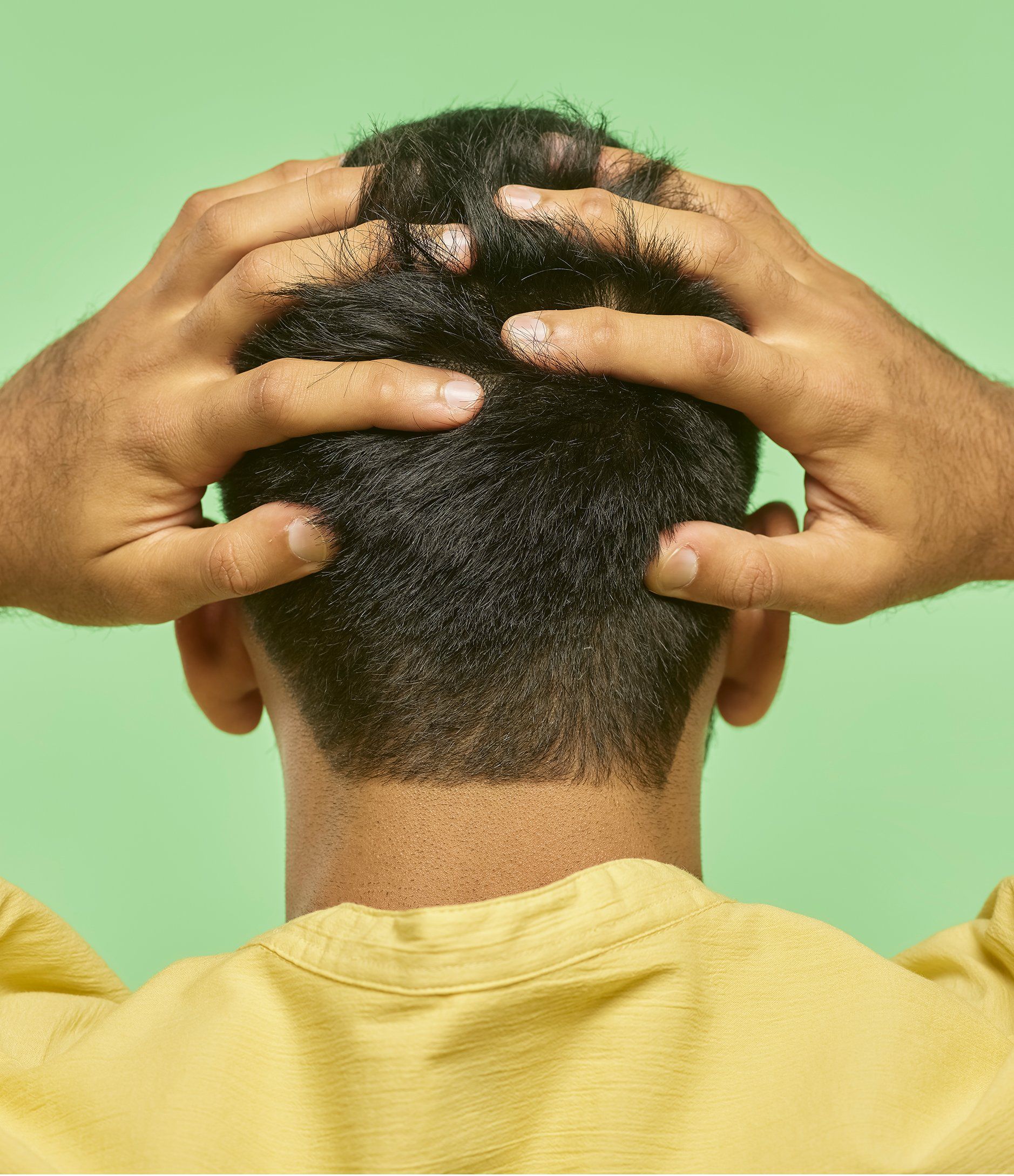 Male pattern baldness explained | selfologi