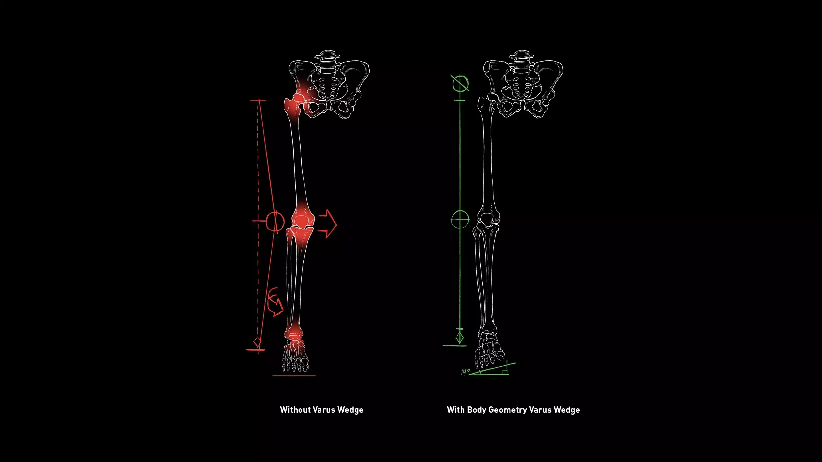 Body Geometry Innovation