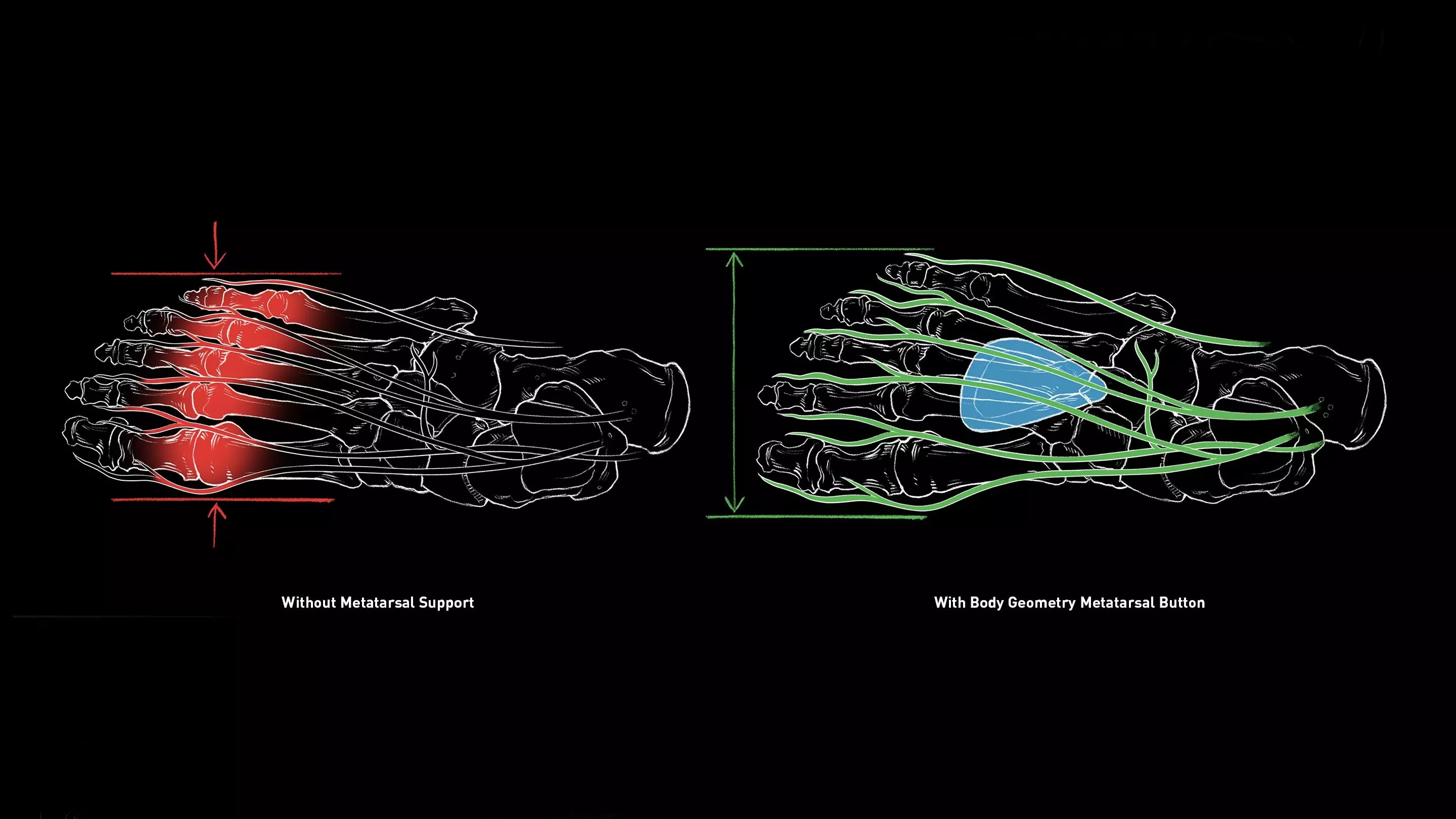 Body Geometry Innovation