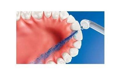 مضخة تنظيف الأسنان فيليبس سونيكير برو + فوهات التنظيف الإصدار الثالث