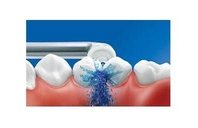 مضخة تنظيف الأسنان فيليبس سونيكير برو + فوهات التنظيف الإصدار الثالث